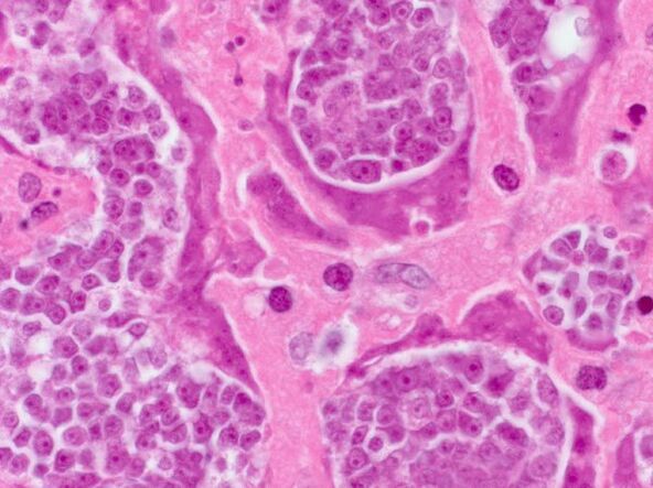 Investigación sobre parásitos nunha persoa