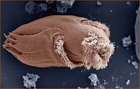 Microorganismos patóxenos en humanos