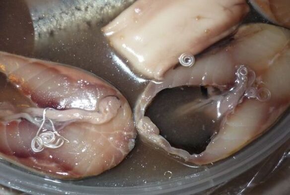 Vías de infección en humanos a través de parasitos