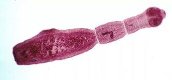 Como desfacerse dos parasitos no corpo humano