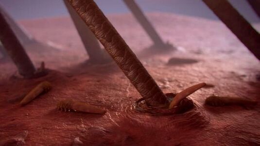 parasito subcutáneo humano ao microscopio