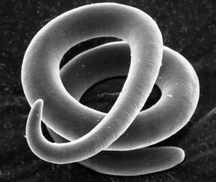 Trichinella baixo o microscopio