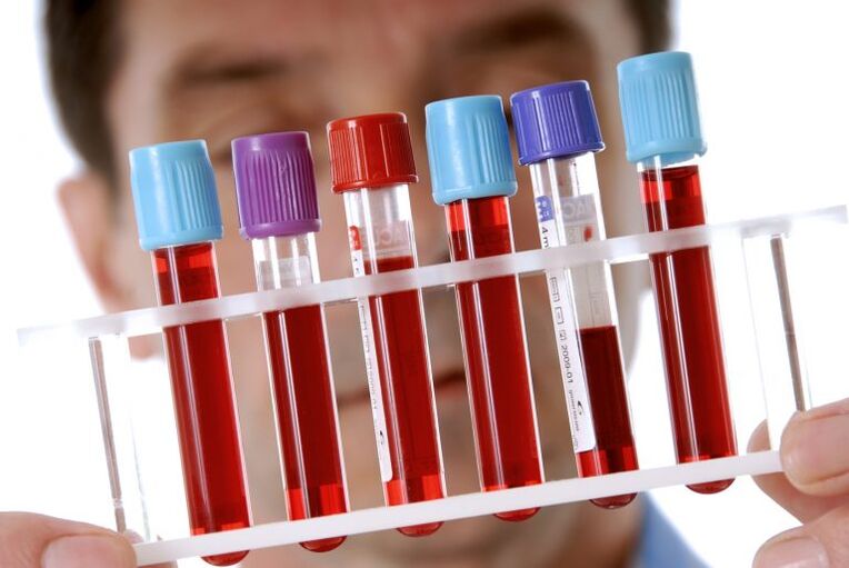 Análise de sangue para diagnosticar enfermidades de vermes